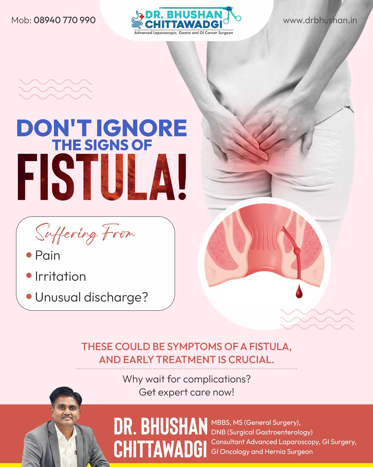 Best Fistula Treatment in Bangalore – Dr. Bhushan Chittawadagi | Leading Colorectal & Laparoscopic Surgeon