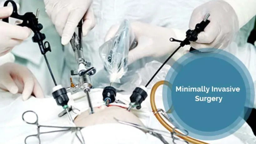 Competitive Landscape of the Minimally Invasive Surgical Instruments Market