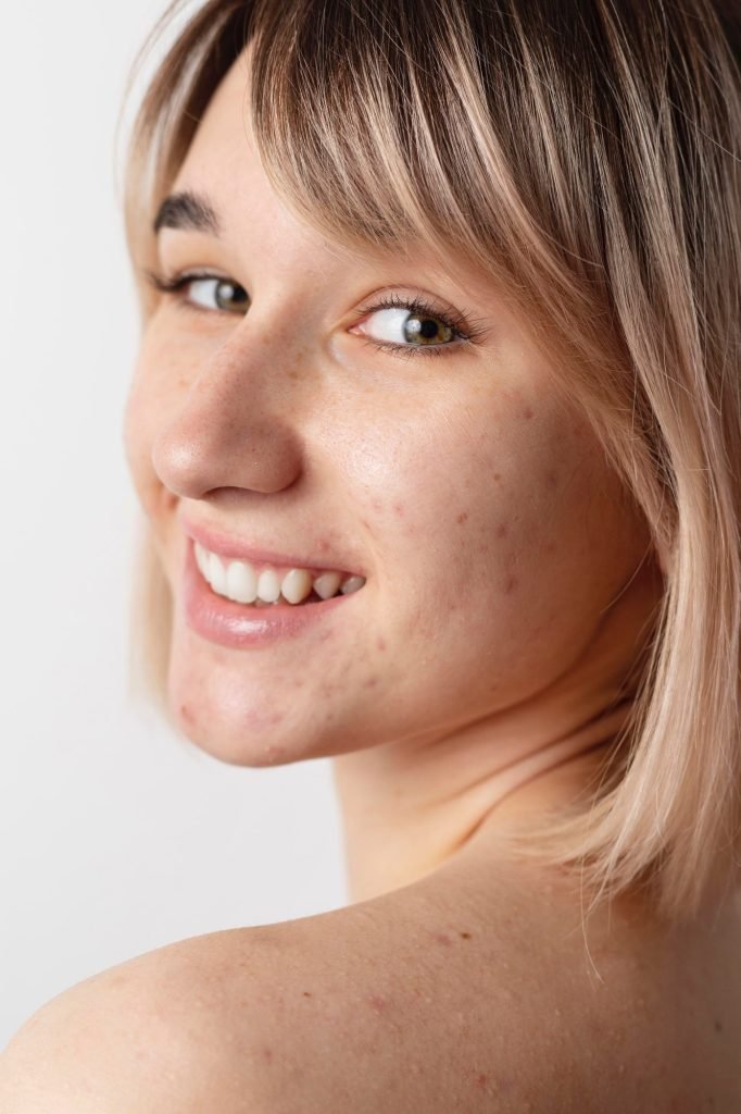 Black Dark Spot Remover: A Safe and Effective Way to Clear Your Skin