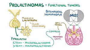 Managing Menstrual, Fertility & Prolactinoma with Dopamine Agonists