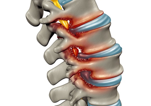How to affect the spinal cord injury in the human body