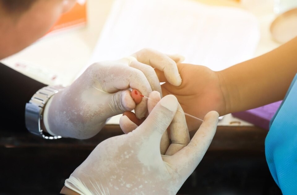 Choosing the Right Wart Removal Equipment: A Buyer’s Guide